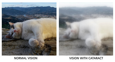 Vision with cataract simulator