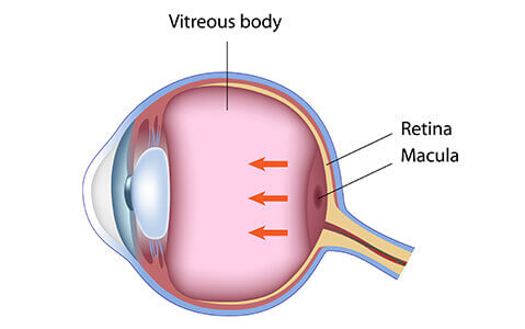 Diagram of the eye showing retina and macula